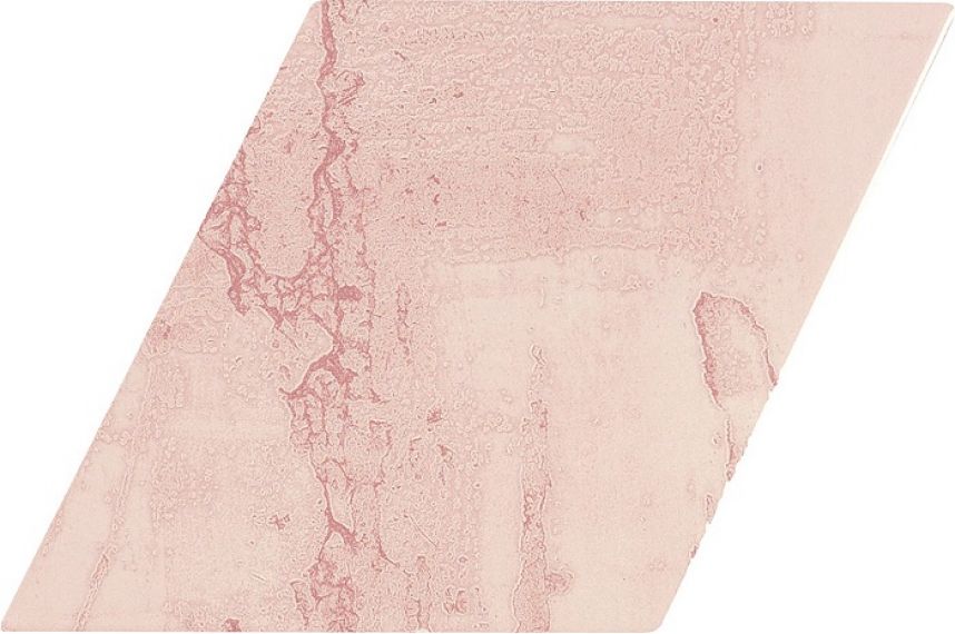 ROMBO SNAP PINK 15X29,5