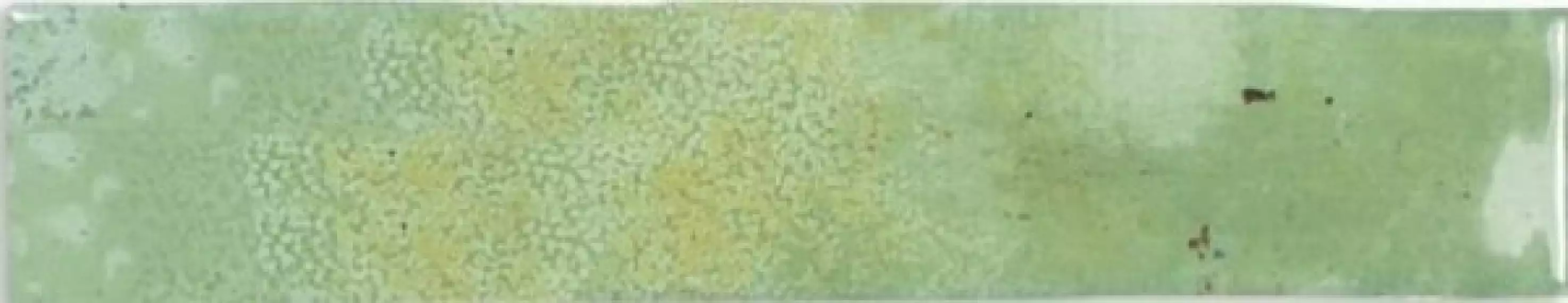 123146 MOSS 5x25